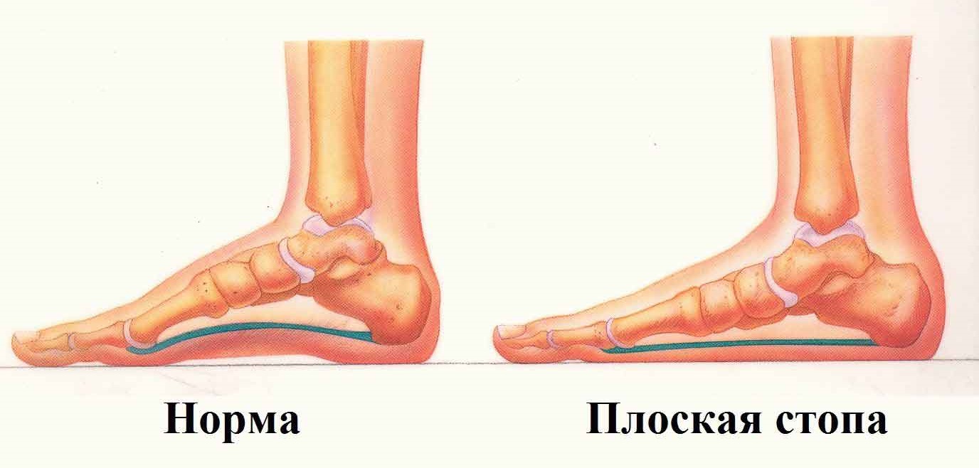 ����� ���� ��-�� ������������